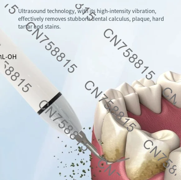 (electromagnetic systems) ultrasonic scalers，Dental scaler handle compatible with ems