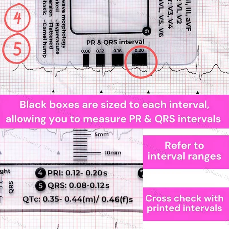 بطاقة تفسير ECG ذات 7 خطوات، دليل مرجعي لـ ECG EKD للجيب المحمول، معدات للتمرين في صالة الألعاب الرياضية، مراقبة الصحة