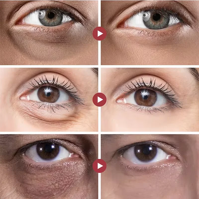 Masque pour les yeux au collagène déformable, patch pour les yeux, resserrement instantané, anti-poches, élimine les cernes, hydrate, lisse, soins pour la peau