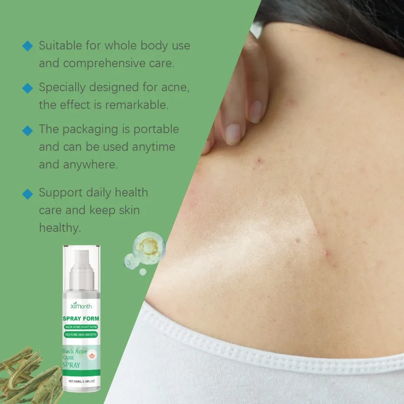 Herbal Back Acne Care Spray Refreshing Skin Fade Acne Spots Shrink Pores Whitening Moisturizing Essence Oil Control Spray