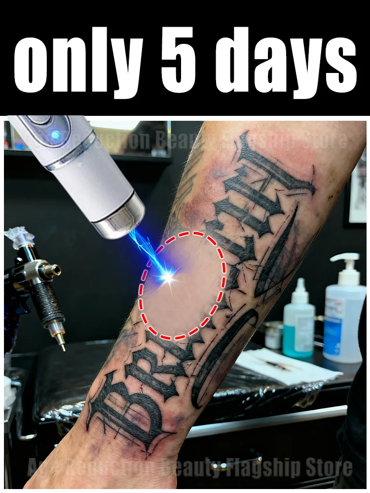 

Популярные товары в 2025 году: средства для очищения кожи, инструменты для ремонта корней лазера синего света, модернизированные в второе поколение.