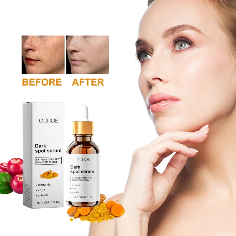 

Осветляющая эссенция - увлажняет, увлажняет, подтягивает кожу лица, восстанавливает тьмяность сияющей кожи.