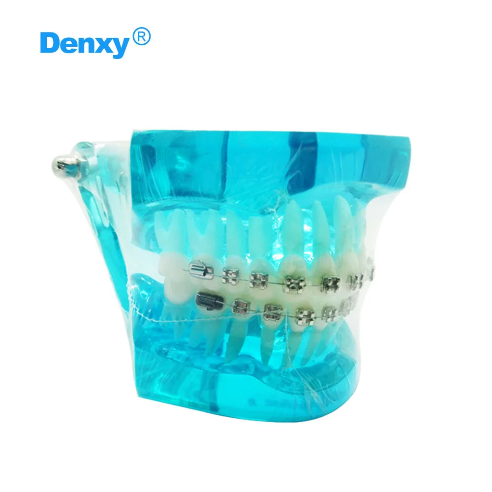 Denxy 1 pcs Dental Teaching Model For Patient Demos Learn Instruction Model With Metal Brace Dentist Teach Tool