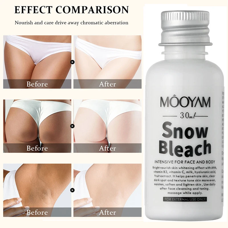 Effective Body Whitening Cream Lighten Thigh Inner Joint Dark Melanin Remove Underarm Knee Bleach Private Parts Brighten Lotion