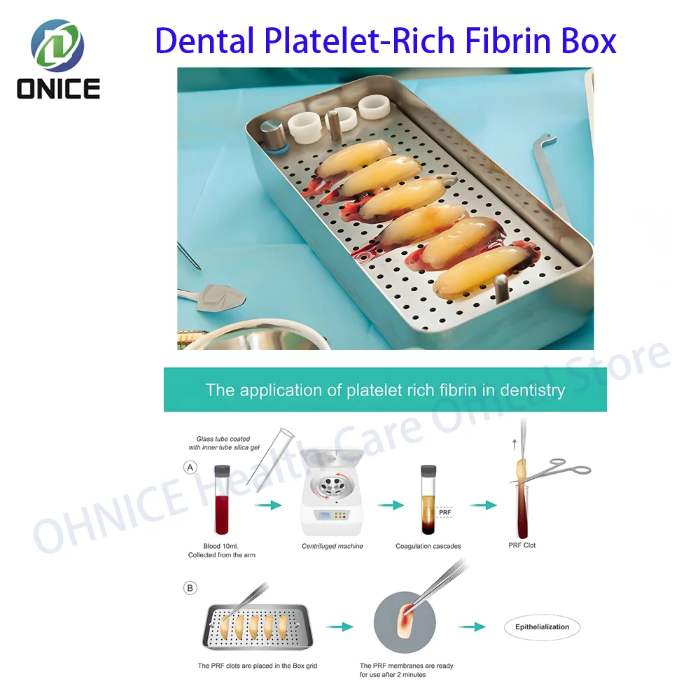 

Пластина для зубного имплантата, насыщенная коробка Fibrin, коробка PRF CGF GRF, стоматологический лабораторный инструмент, органайзер для хранения стоматологической хирургии