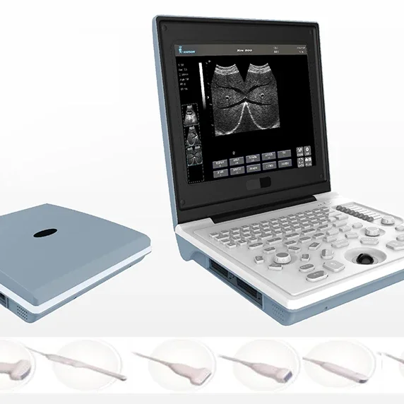 A laptop type black and white ultrasonic scanner with discounted prices