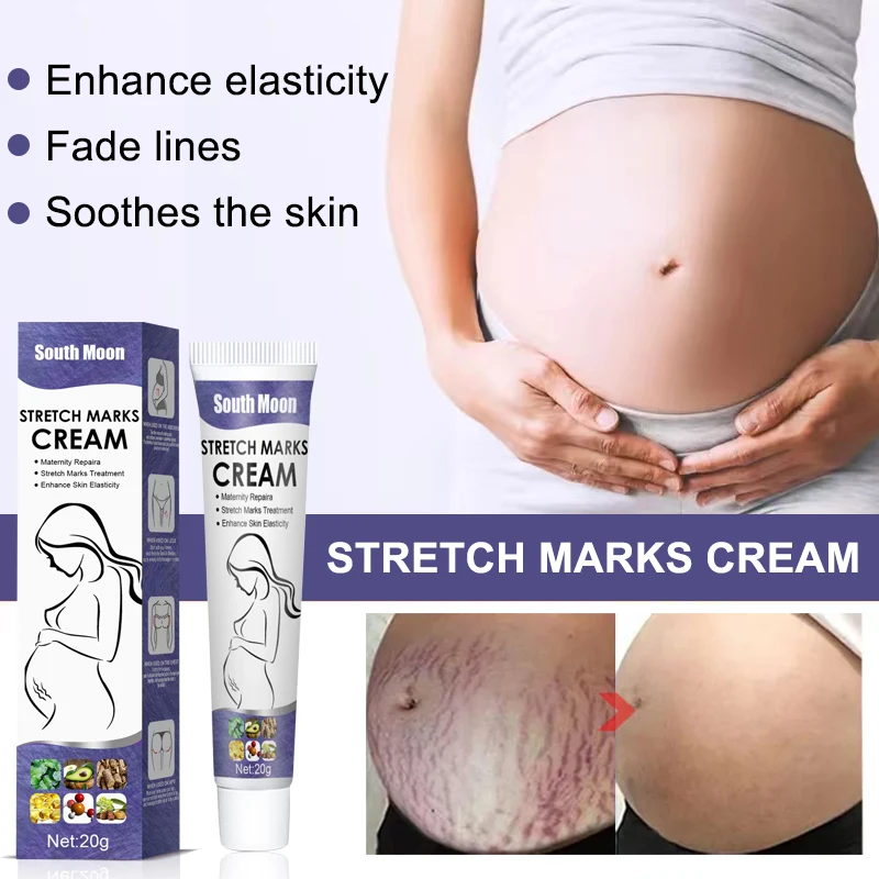 Stretch Marks Permanent Removal Cream Eliminate Body Belly Stretch Marks Swelling Marks Remove Skin Cracks