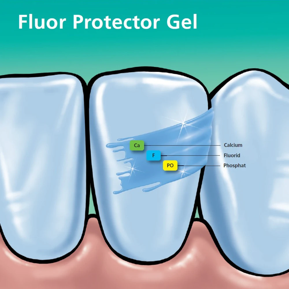 Ivoclar Vivadent AG Fluor Protector Dental Fluoride Varnish Gel 0.4ml Teeth Sensitive Desensitizing Protective Oral Care Product