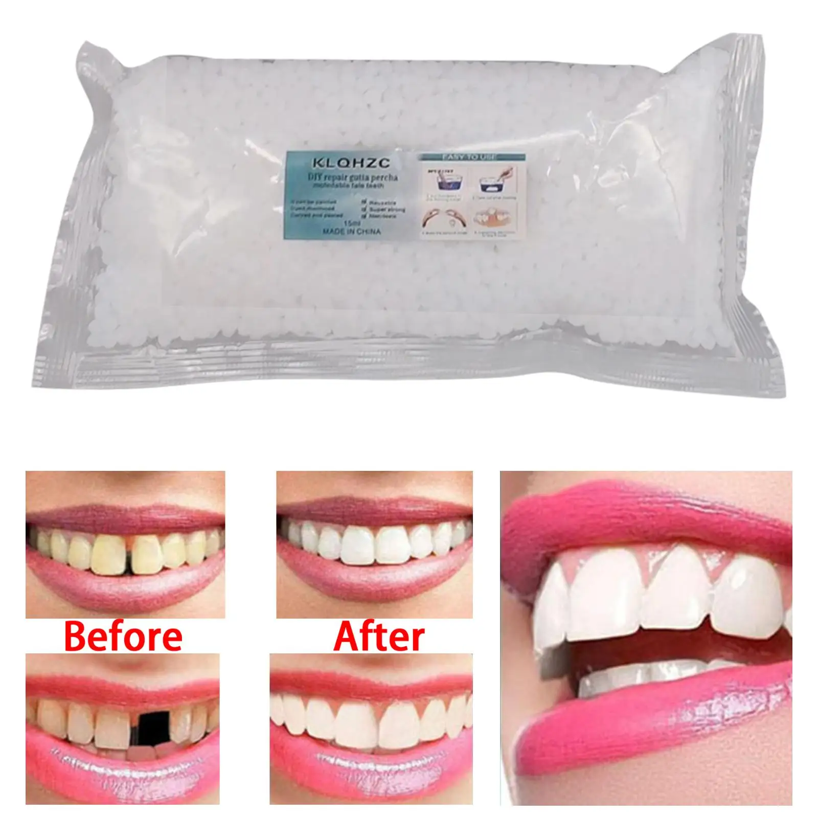 Teeth Repair Kit 100G Teeth Replacement Kit Moldable False Teeth Thermal Fitting Beads Filling The Missing Broken Tooth Safe