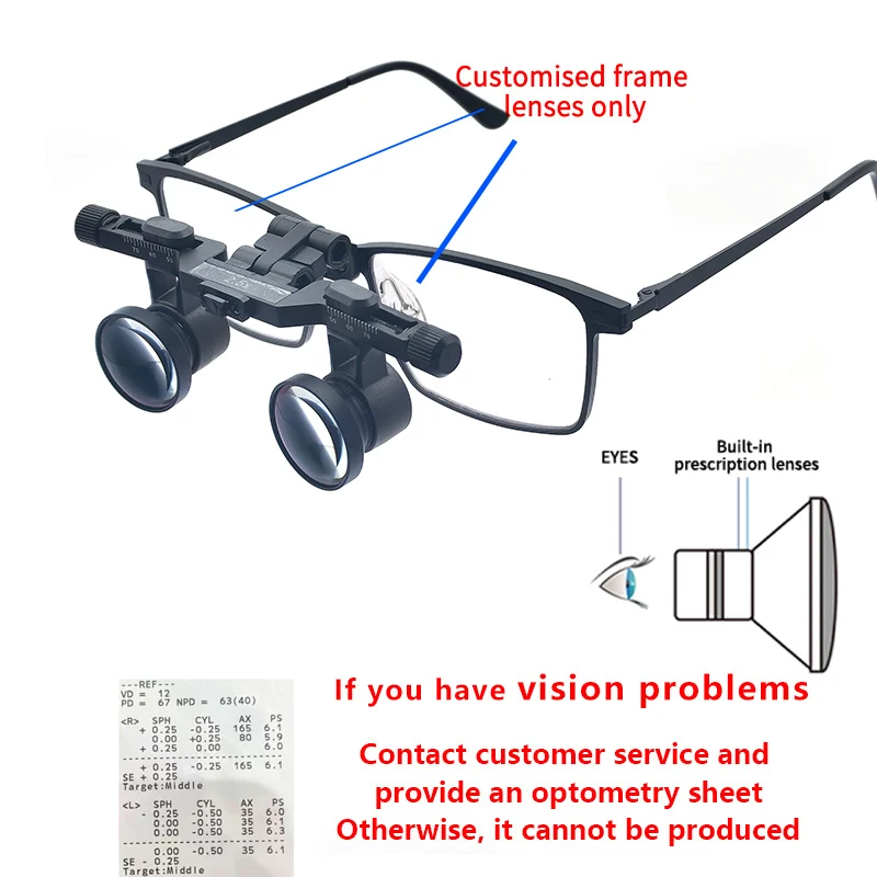 Lentile Prescripție Personalizate Myopia - usage example