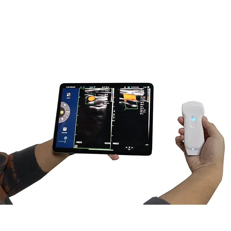 Wireless Wifi Ultrasound Scanner Probe  3 in 1 Color Portable Doppler Handheld Double Head Convex Usg Pocket 128 element