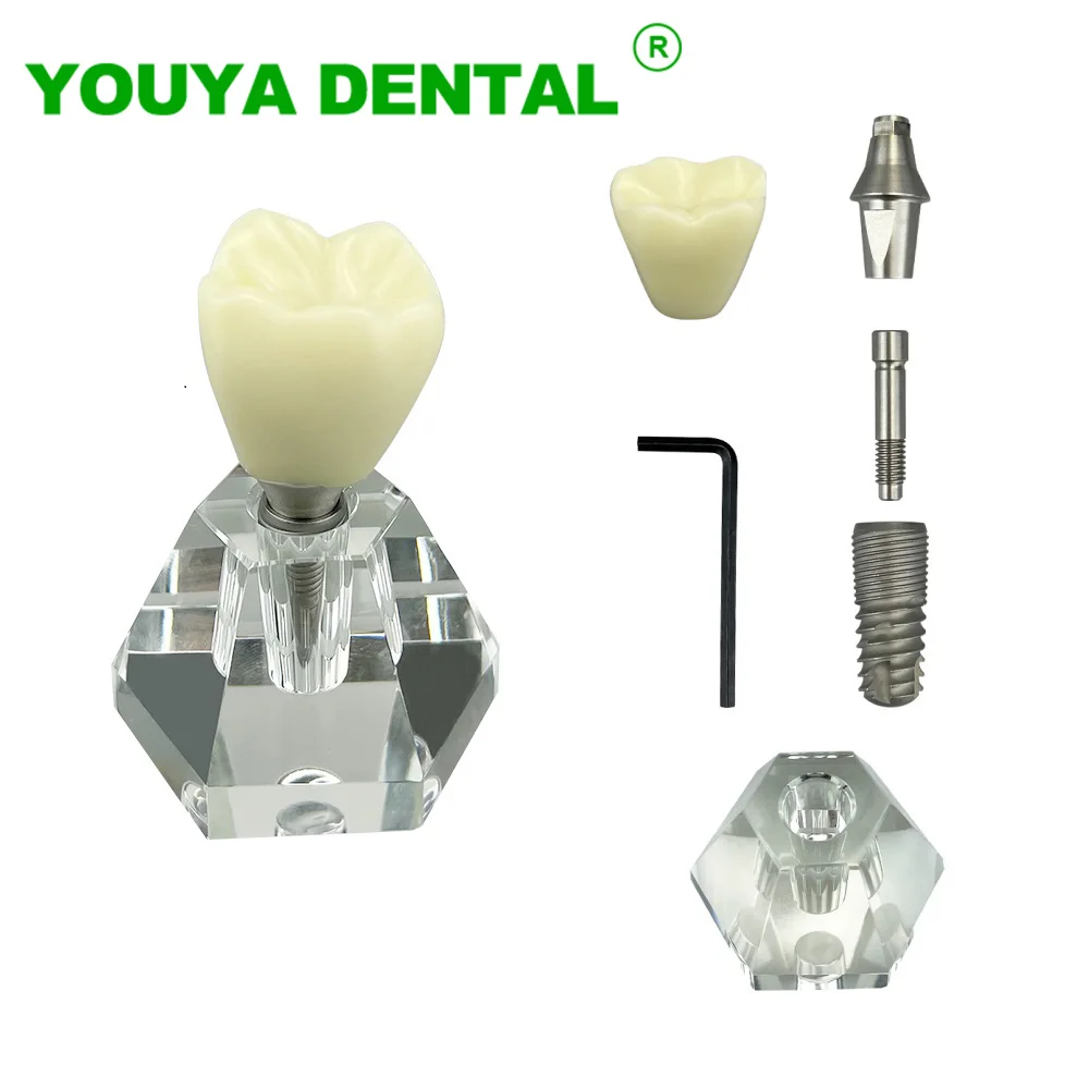 Dental Implant Model 4 Times Single Tooth Crown Demonstration Models Removable Teeth Teaching Study Model For Dentist Clinics