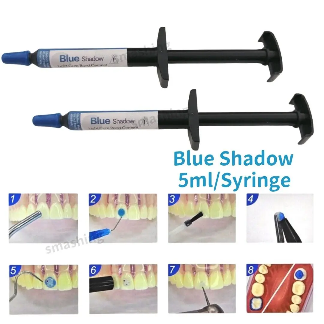 Dental TURBO Composite Resin Orthodontic Adhesive Blue Light Cure Band High Quality Reliable Dental Bonding Solution