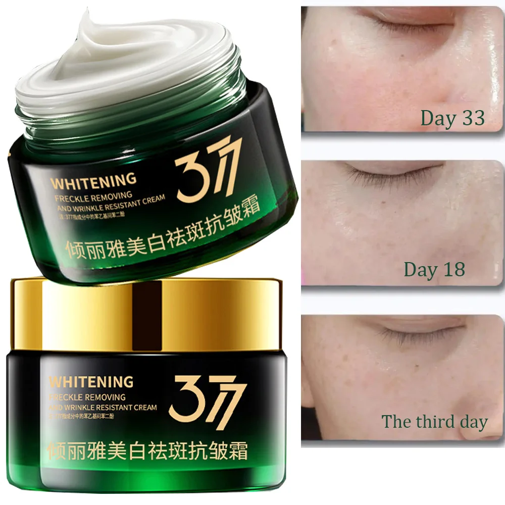 

Отбеливающий крем от веснушек, удаление мелазмы, корректор темных пятен, осветление меланина, пигментация, осветление кожи