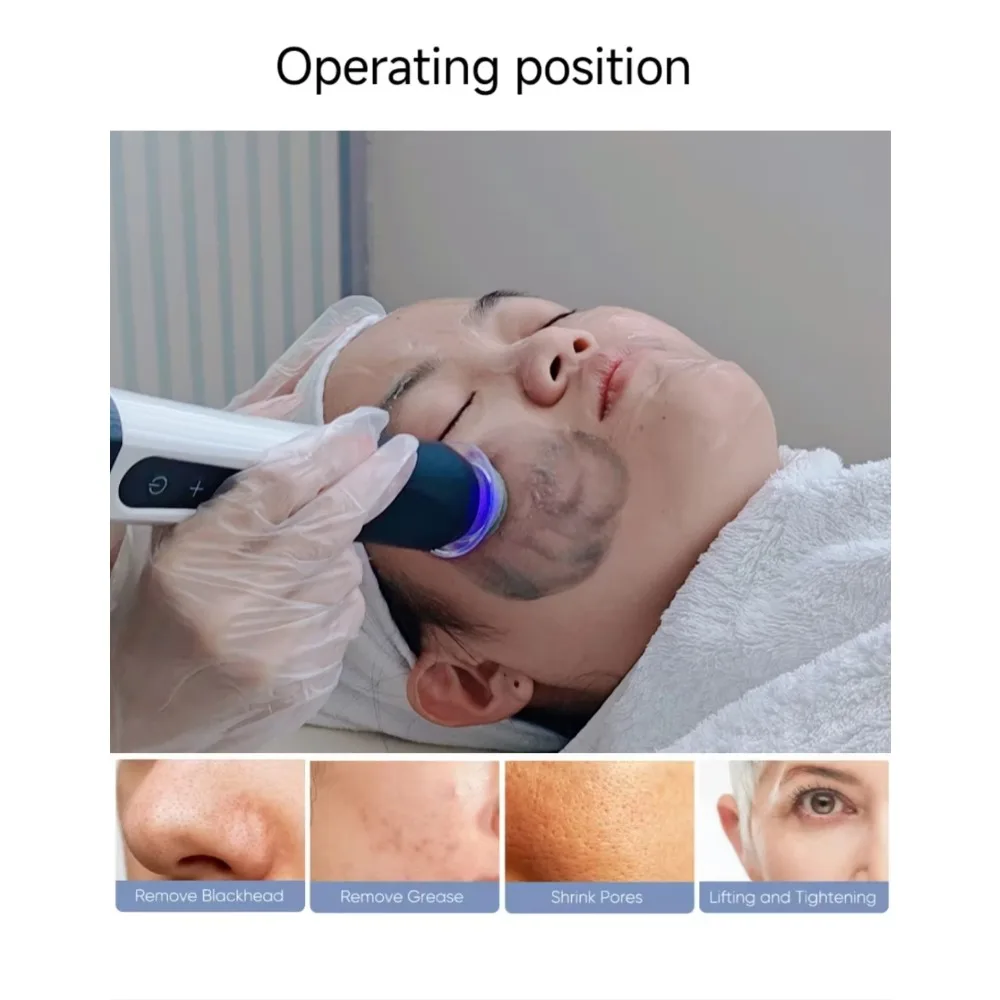 2025 رائجة البيع CO2 الأكسجين القرون كبسولة المصل للأكسجين النفاثة قشر آلة الوجه CO2 القرون فقاعة هيدرات الأكسجين جراب العلاج