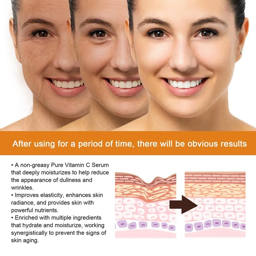 Retinol anti-envelhecimento soro rejuvenescimento desbotar linhas finas colágeno iluminando rosto cuidados essenciais óleo hidratante anti-rugas s6a9