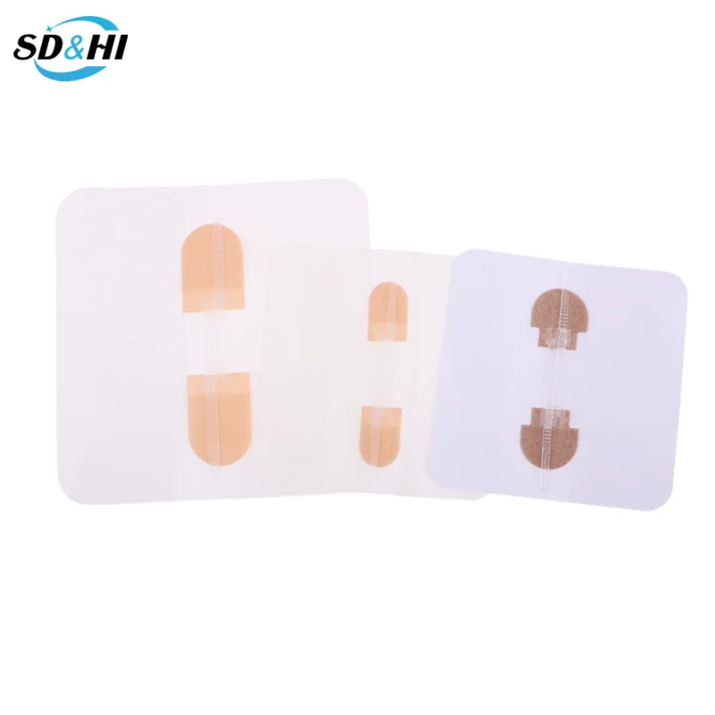 1Pcs Fast Suture Zipper Band-Aid Zipper Tie Wound Closure Patch Hemostatic Patch Wound Outdoor Portable