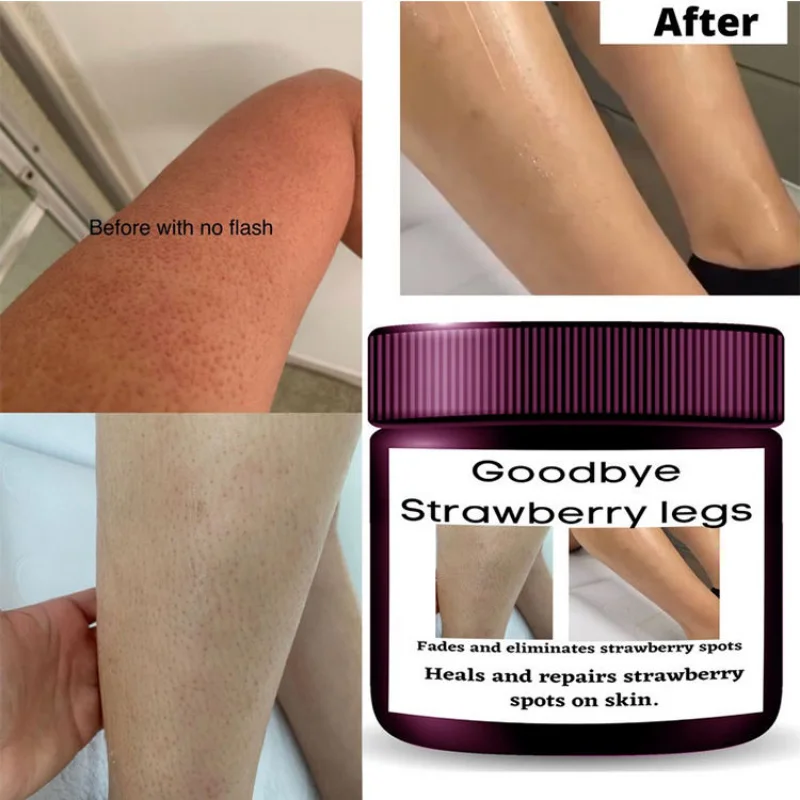 Whitening Strawberry Legs Cream Fades Strawberry Spots Skin Smooth Strawberry Legs Exfoliating Cream for All the Boday