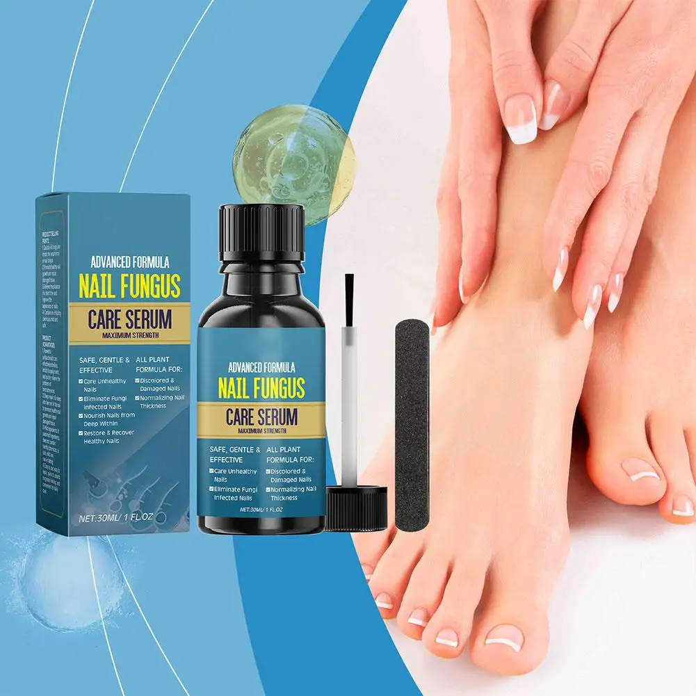 

Средство для лечения грибка ногтей, натуральное нежное формуние и уход за поверхностью, питательное средство для ногтей, чистка ногтей, рук J9N1