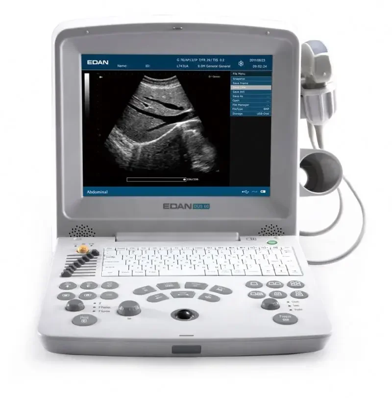 Edan-DUS-60 Portable Medical Ultrasonido Sonografo Portatil Ecografo Edan-DUS-60 Ultrasound Machine