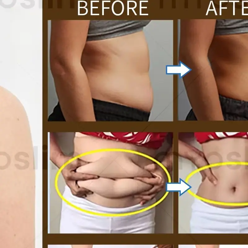 RF Nova EMS Body Slimming Sculpting Machine MYOslim  NEO, Professional Equipment, Build Muscle, Fat Burning, EMS