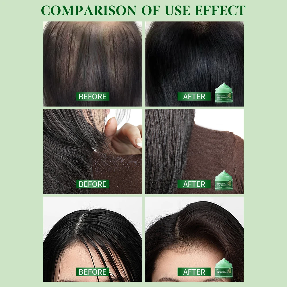 Thumbnail 2 - #8 Compare Scrubs Treatments Before You Buy