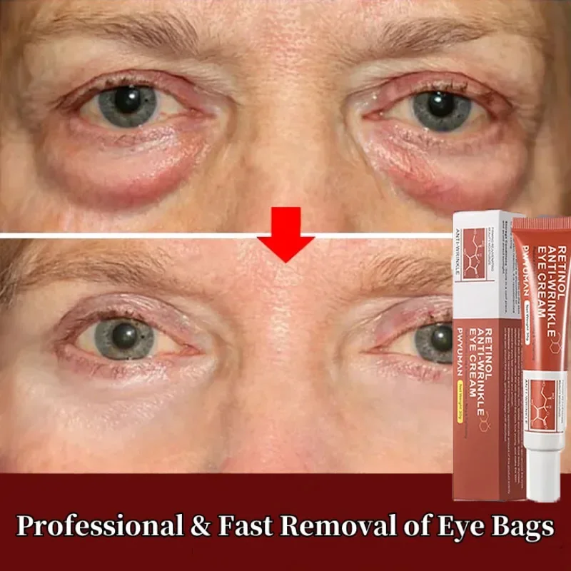 

Instant Eye Bag Removal Cream Retinol Anti-wrinkle Firming Skin Fade Fine Lines Anti Dark Circle Puffiness Brighten Eye Care