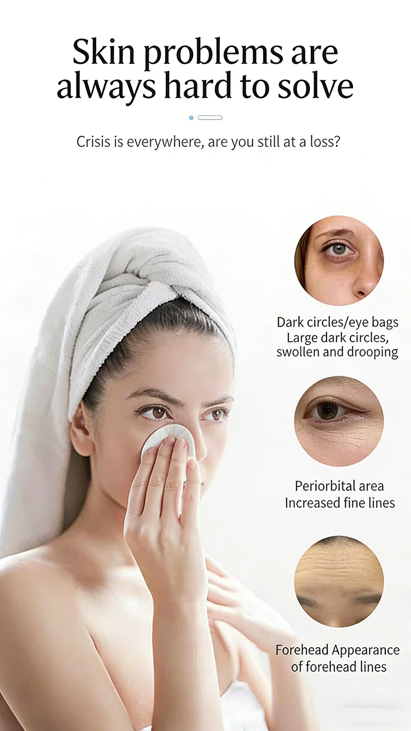 أربعة أجيال من جهاز التجميل الماجستير للعين والوجه لصالونات التجميل لشد والقضاء على الهالات السوداء للوجه #3