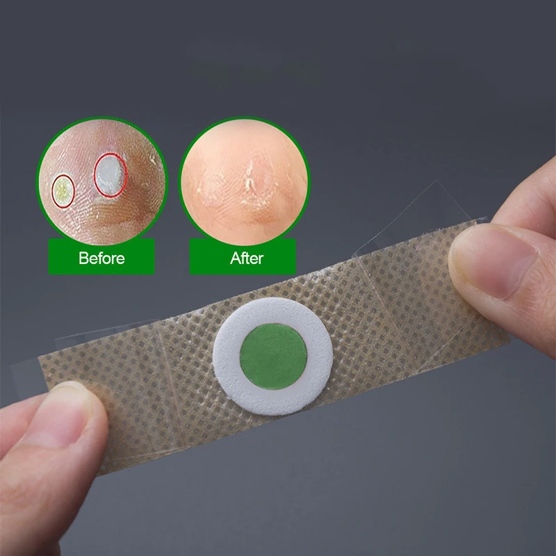 6/12/18/24/30/36 Uds. Cojines para eliminar callos y maíz, parches, accesorios para zapatos, productos para el cuidado de los pies
