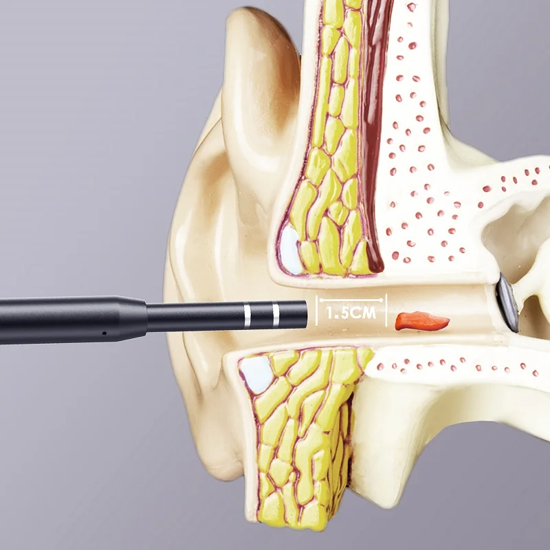 3in1 Ear Endoscope 3.9mm 5.5mm Lens USB Type-c Visual Ear Pick Spoon Otoscope for Android Phones PC High Resolution Ear Cameras