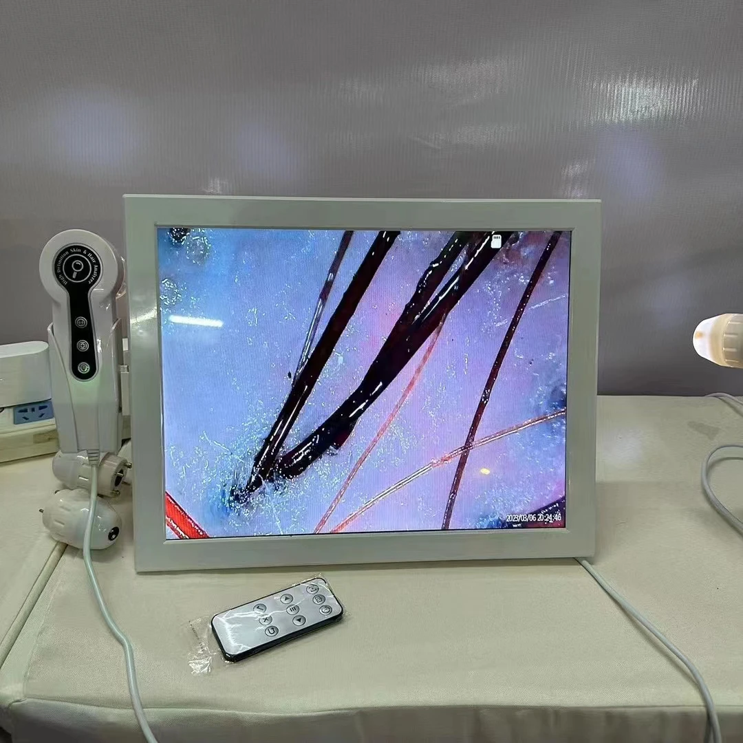 トリコスキャン毛髪・頭皮分析 頭皮脱毛症検出器 高解像度画像毛髪分析器