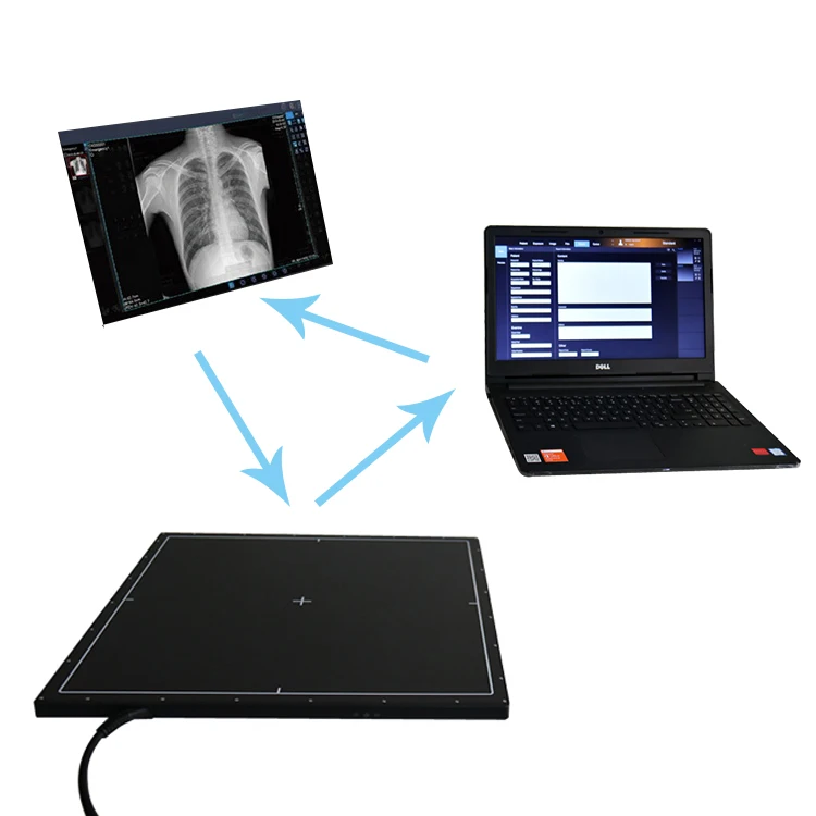 Best Price 17*17 Wireless Portable Flat Panel X Ray Detector Dr Flat Panel Detector Flat Panel Detector Veterinary