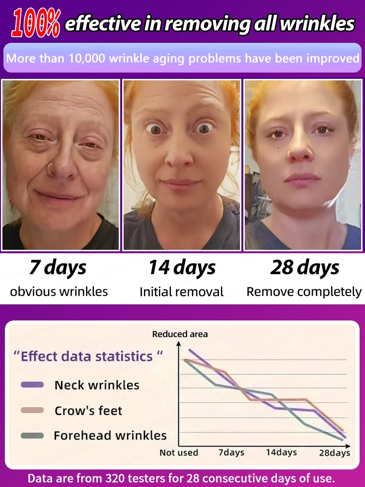 Reduce faint lines glow with confidᴇɴᴄᴇ ғʟᴀᴜɴᴛ sᴍᴏᴏᴛʜ ʏᴏᴜɴɢ sᴋɪɴ ғᴜʟʟ ᴏғ ᴀᴛᴛʀᴀᴄᴛɪᴏɴ