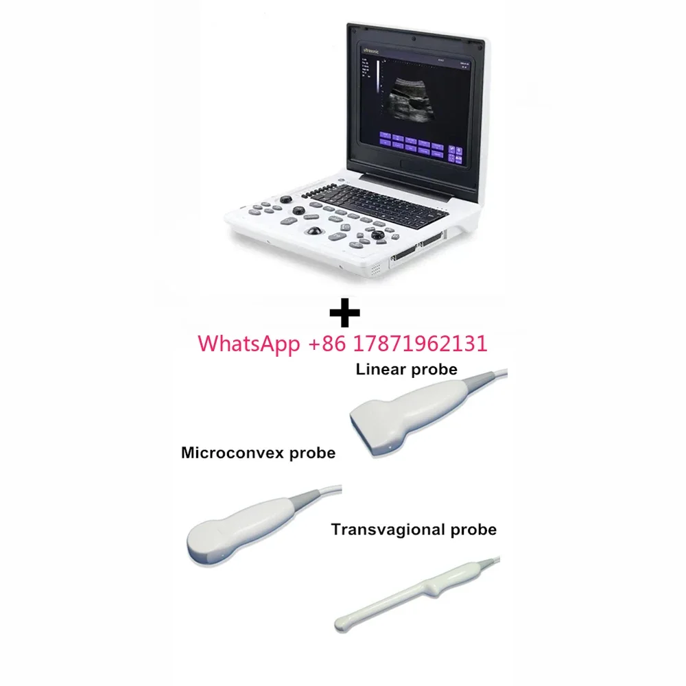 New 12 Inch LED Laptop Portable Notebook Sonography USG Ultrasound Scanner Diagnostic Machine