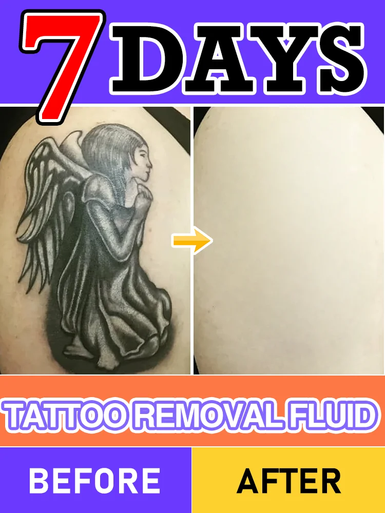 

Professional Tattoo Removal: 7-Day Natural Formula, Efficiently Decompose Pigments without Traces