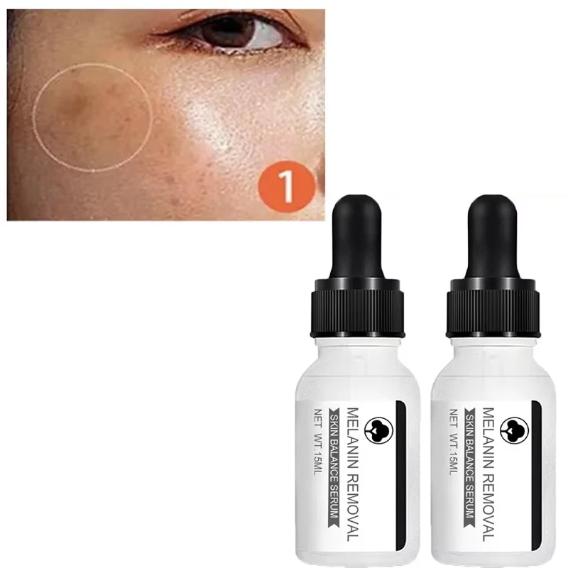 Niacinamide Dark Spots Remover Serum Freckle Whitening Moisture Removal Black Dot Melasma Chloasma Face Skin Care Cream