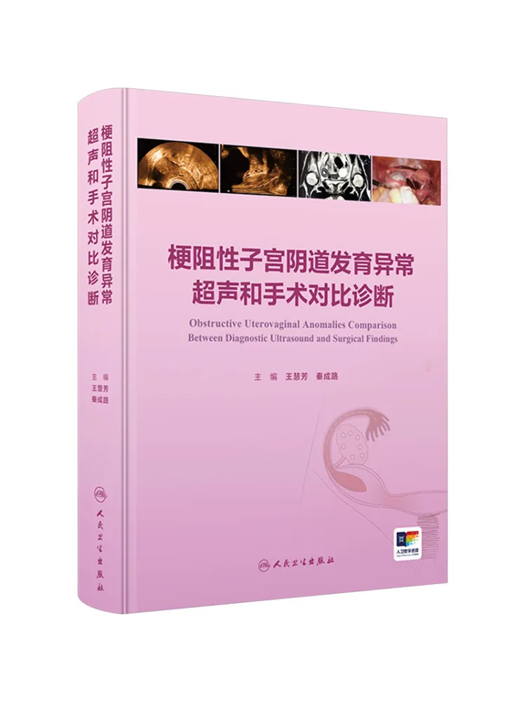 Book-Winshare Comparative Diagnosis Of Obstructive Uterine Vaginal Developmental Abnormalities Using Ultrasound and Surgery