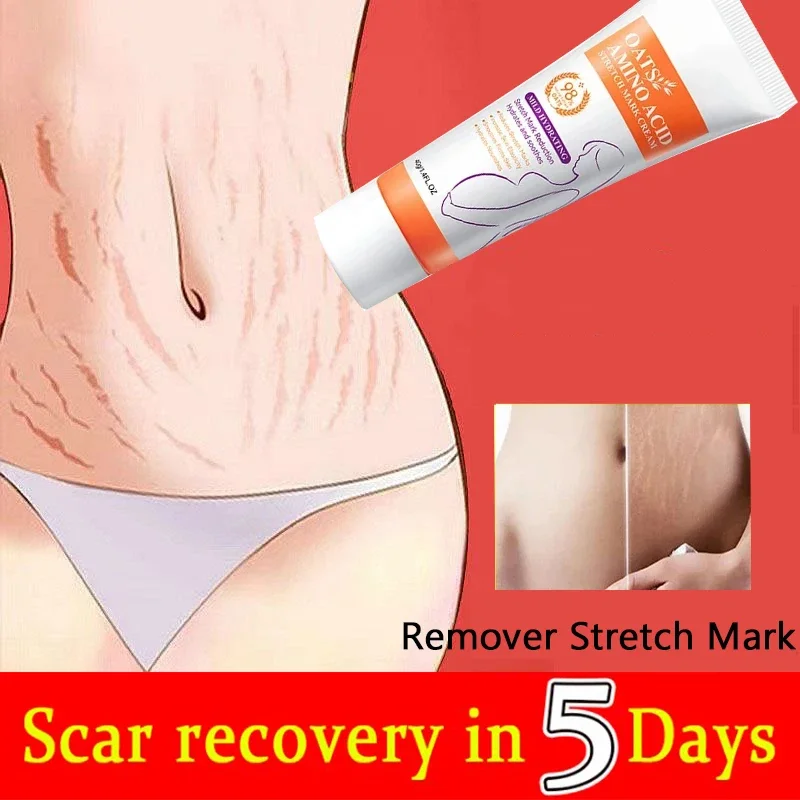 Removes Stretch Mark Cream To Remove Postpartum Obesity Pregnant Women Repair Anti-Aging Winkles Firming Body Cream Skin Care