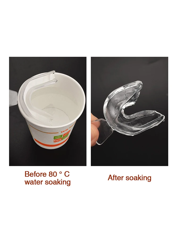 Protège-dents en Silicone, plateau de protection buccale pour dormir, ensemble d'accolades orthodontiques pour le bruxisme, meulage, sans ronflement, blanchiment des dents, protection