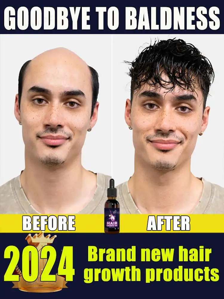 

98% of buyers buy again, have more and more hair, say goodbye to baldness, thick hair,Hot selling product