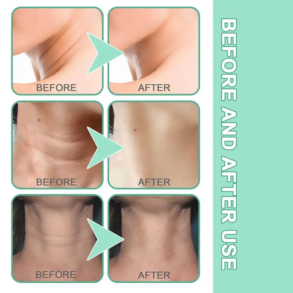 110g Neck Firming Anti-Wrinkle Double -Roller Tone-Up Skin Rejuvenation Whitening Care Moisturizing Beauty Cream Serum Care E3E5