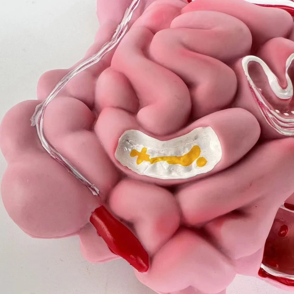 Adult Large Intestinal Pathology Model Human Digestive System Anatomy Model Medical Teaching Tools Gastrointestinal Lesions