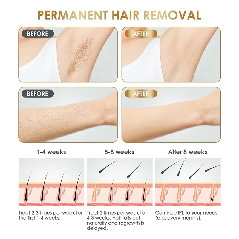 A15Q-Home Painless Hair Removal Device Full Body Painless Hair Removal Device Suitable For Bikini Line, Underarms, Legs, Arms EU