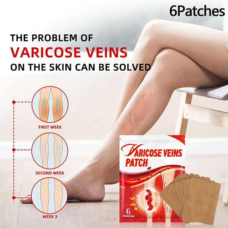 6 Patches/Pack Varicose Vein Patch External Plaster Shu Ning Patch Breathable Long-lasting Soothing Spider Leg Vein Care Patches