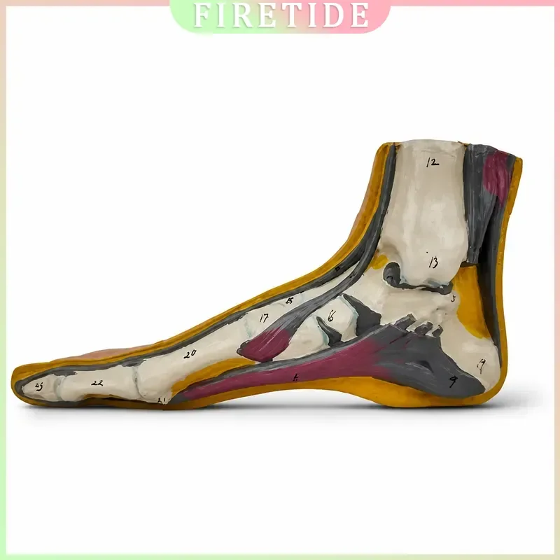 Healthy vs Deformed Foot Model Flat Foot Normal Arch Pes Cavus Pathology Display for Medical Teaching