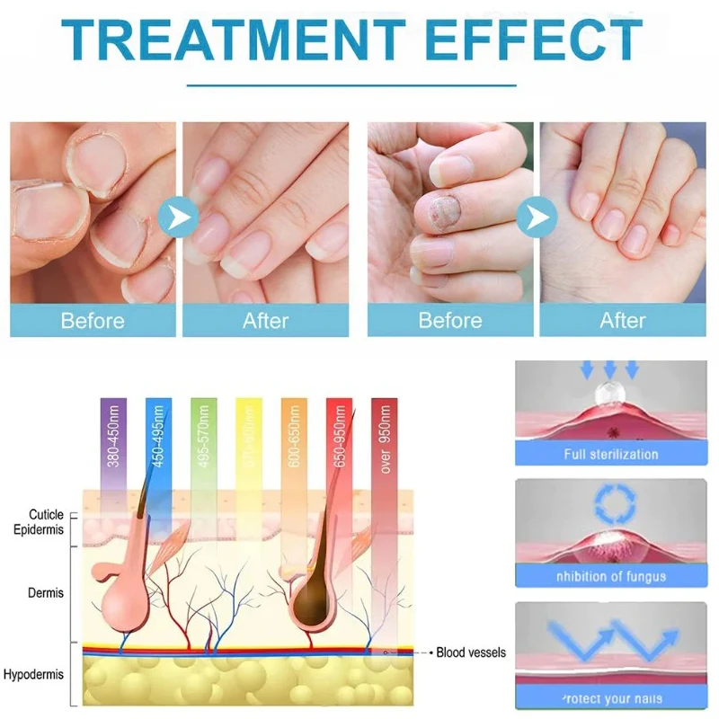 High Frequency Facial Machine Electrotherapy Wand Glass Neon + Argon Wands Inflammation Treating nail fungus