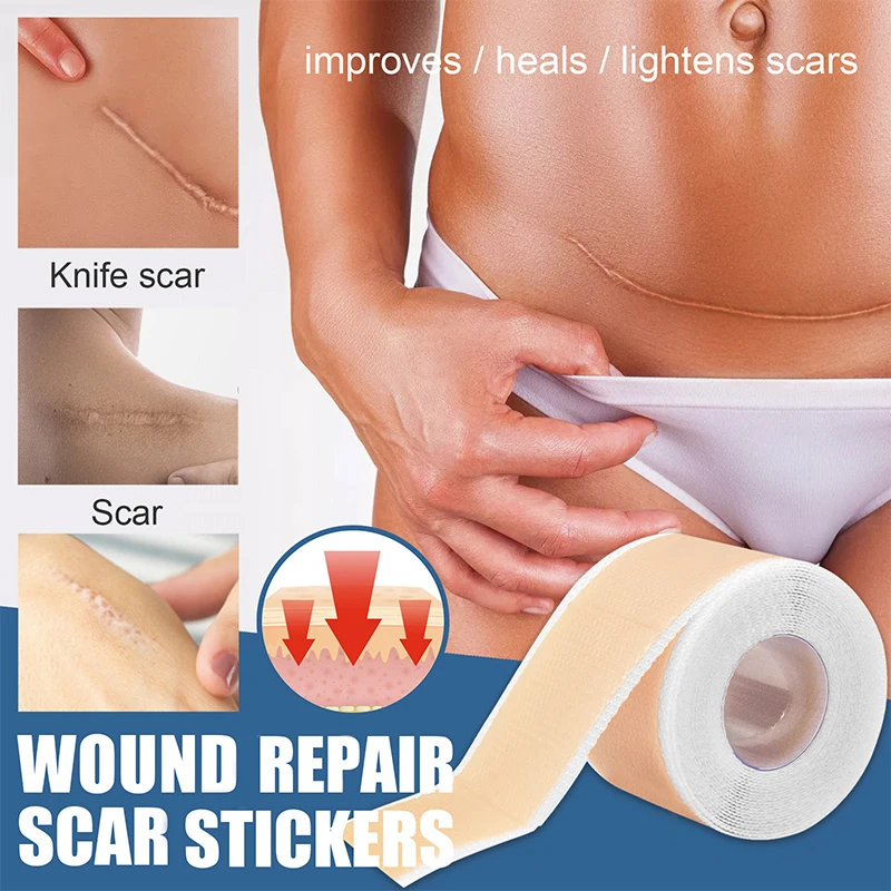 4X150CM Silicone Scar Patch Skin Repair Sheets Removal Self-Adhesive Stretch Marke Burn Acne Scar Tape Skin Care Tool