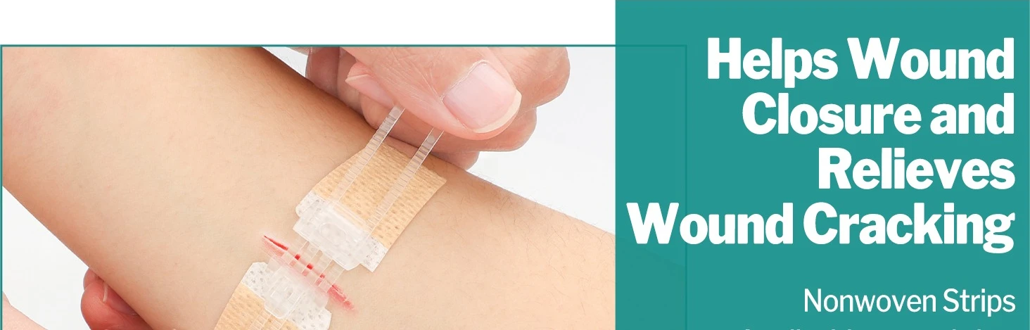 Sanke Rescue 14/28 Pack Wundverschlussstreifen Reißverschluss-Verband Notfall-Wundverschluss-Set Wundreparatur-Verschlussvorrichtung – Detail 1