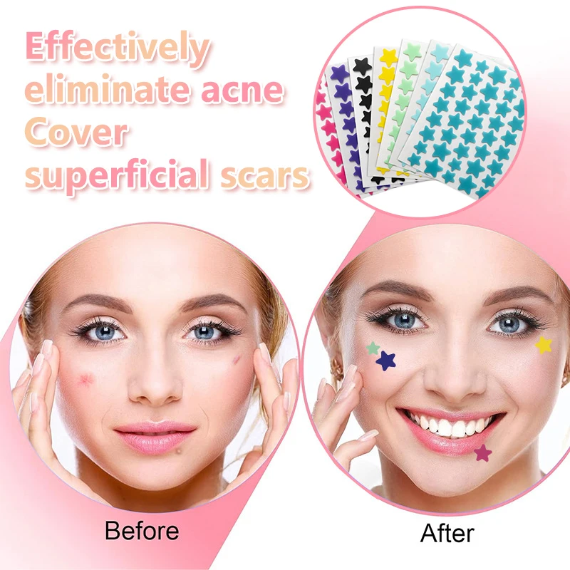 40/160 Stuks Ster Puistje Patch Acne Kleurrijke Onzichtbare Acne Verwijdering Huidverzorgingsstickers Concealer Face Spot Beauty Make-Up Tool