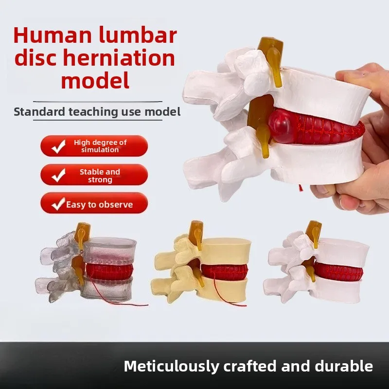 Simulated lumbar spine model, intervertebral disc 1:1.5 human skeleton spine spine anatomy medical teaching skeleton